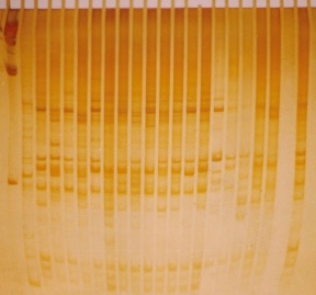 DNA. Molecular markers