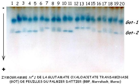glutamate oxaloacétate transaminase