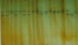 enp zymogram