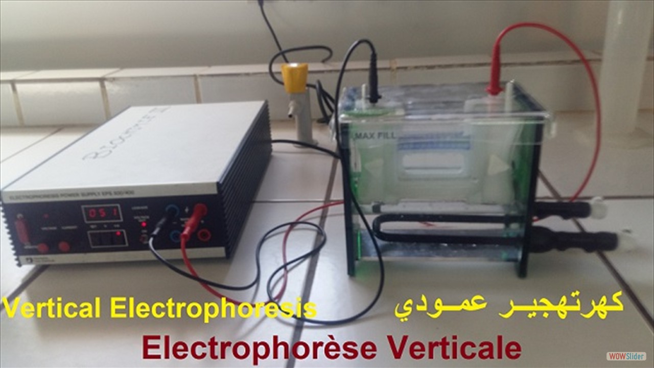 04-electrophoresis-vertical